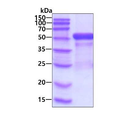 SDS-PAGE: Recombinant Human Cytokeratin 20 His Protein [NBP2-23165]